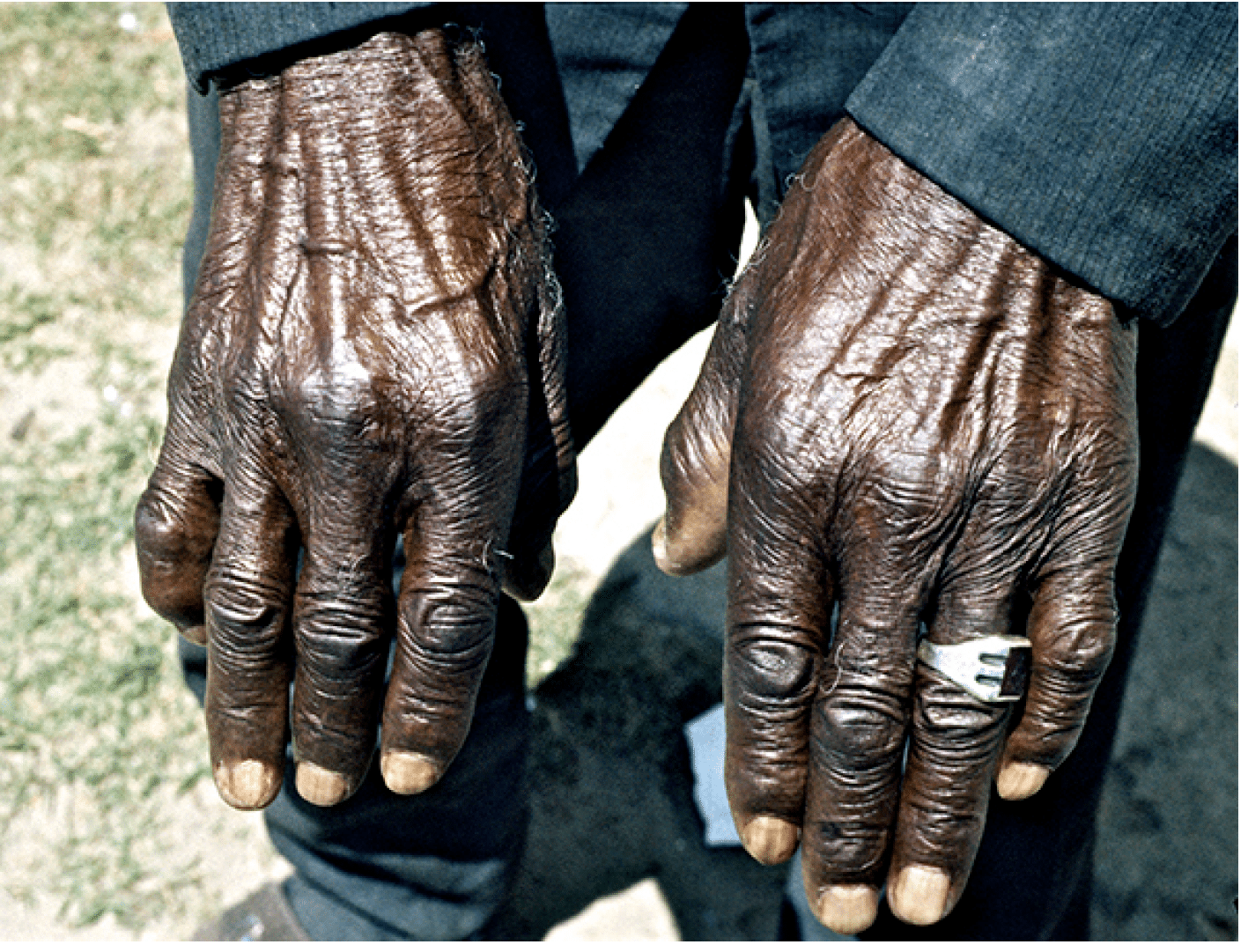 1974 - Bartow, FL  Charles Smith's hands
