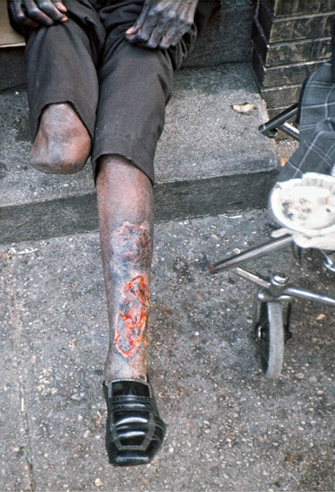 1974 - Jacksonville, FL 