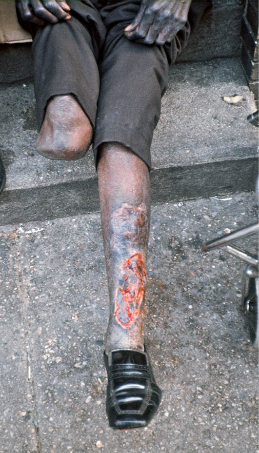 1974 - Jacksonville, FL 